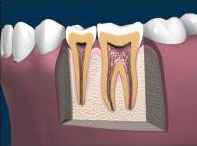 Healthy Tooth Healthy Tooth